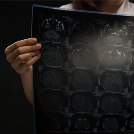 Brain scans printed