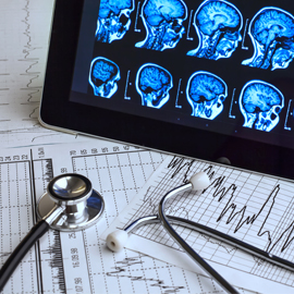 Brain scans on tablet and heartbeat monitor