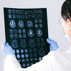 Photo of a doctor looking at brain scans