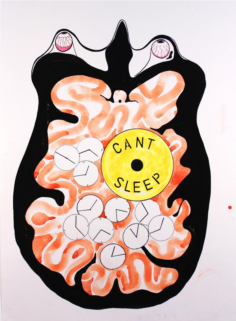 Caption: Insomnia. Credit: Stephen Magrath. CC0 1.0 Universal