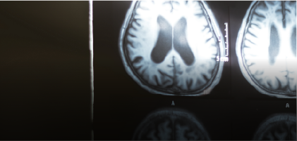 brain scan