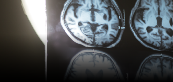 brain scan