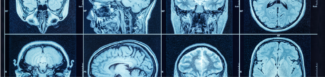 brain xrays
