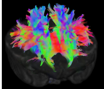 Caption: Structural connectivity in a neonatal brain: different colours represent white matter fibres travelling in different directions. Image credit: Developing Human Connectome Project.