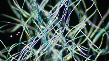 caption:Polyester fleece fibres pictured under a microscope