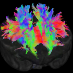 Structural connectivity in a neonatal brain: different colours represent white matter fibres travelling in different directions. Image credit: Developing Human Connectome Project.
