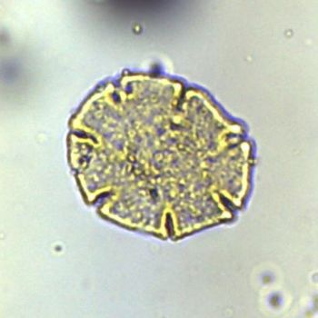 Caption: Pollen sample recovered from the sediment core